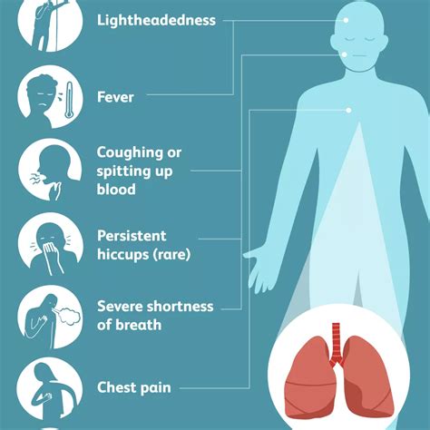 Pulmoner Enfarktüs genel bakış En İyi Sağlık