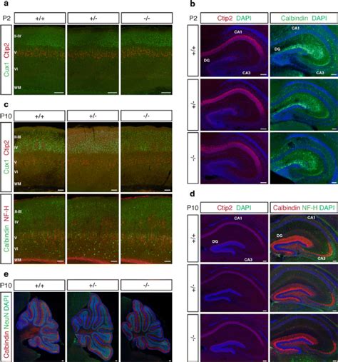 Normal Radial Migration And Lamination Are Maintained In Dyslexia