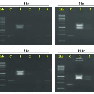 Agarose Gel Electrophoresis Analysis Of Dsrna Of E Vittella After