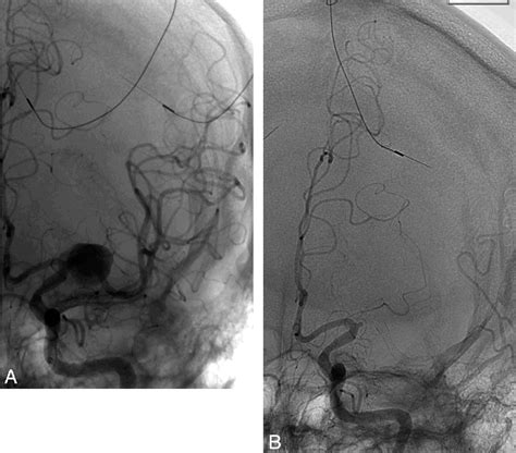 Structure Of Superior Hypophyseal Artery Semantic Scholar