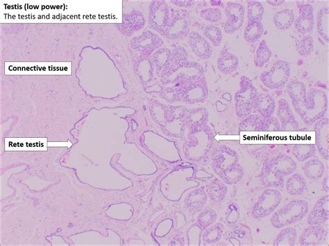 Testis And Epididymis Normal Histology Nus Pathweb Nus Pathweb