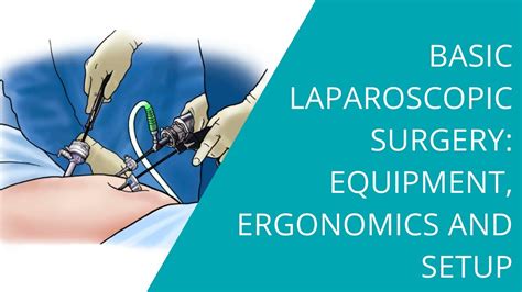 Basic Laparoscopic Surgery Equipment Ergonomics And Setup Youtube