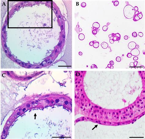 Representative Samples Of Typical Hematoxylin And Eosin Staining Of Hne