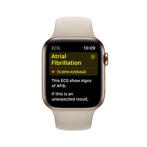 Does Apple Watch Ecg Work In Philippines at Mark Lola blog