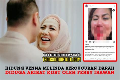 Hidung Venna Melinda Bercucuran Darah Diduga Akibat KDRT Oleh Ferry