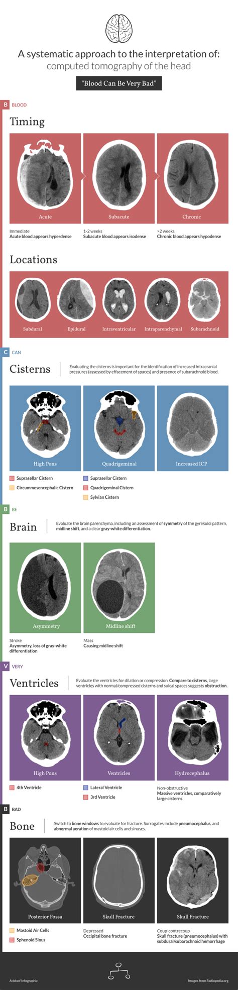 Differential Diagnosis of Infographic: CT Head Interpretation