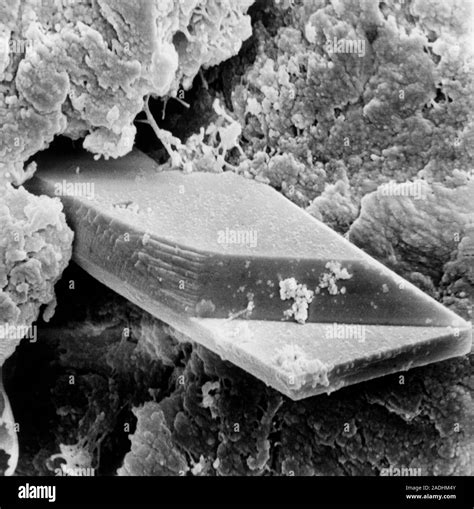 Micrographie électronique à balayage d une section du cartilage d un