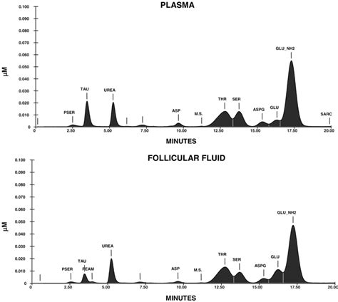 A Representative Of High Performance Liquid Chromatography Hplc