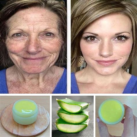 Anti Aging Aloe Vera Magic Cream Stimulates Collagen And Fills In Deep