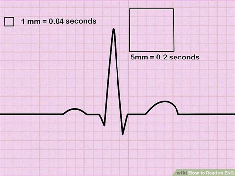 How To Read An Ekg An Interpretation Guide With Sample Illustrations