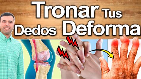 Tronarse Los Dedos Es Malo Porqué Tronar O Sonar Los Dedos Destruye