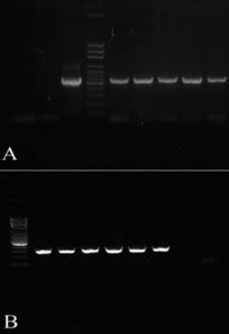 Modification Of Plant Height Via RNAi Suppression Of MdGA20 Ox Gene