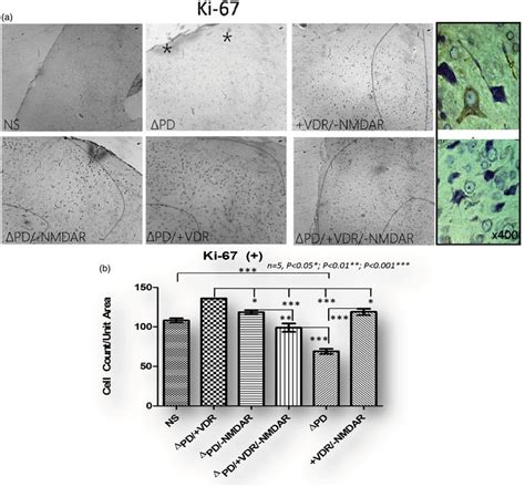 Ki Immunohistochemistry A Ki Expression In The Cortex