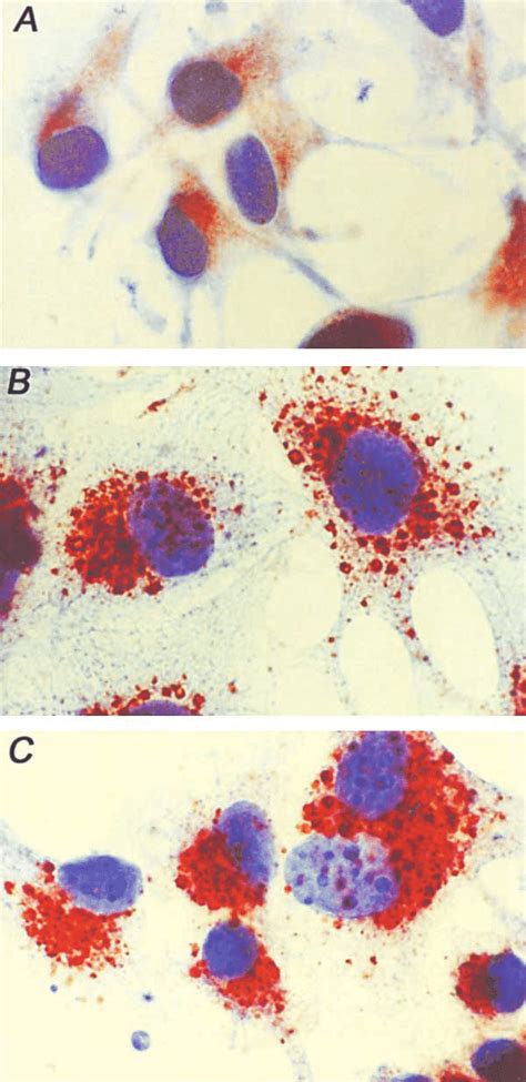 Immunocytochemical Analysis Of Fasl Expression In Human Melanoma Cells