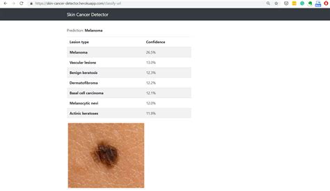 Github Hassanejazul786 Skincancerdetection Webapp Skin Cancer