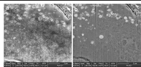 Figure 1 from Focused ion beam (FIB)/scanning electron microscopy (SEM) in tissue structural ...