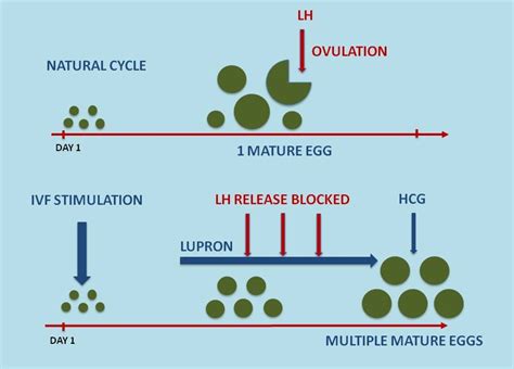 In Vitro Fertilization Ivf Specialist Irving Tx And Arlington Tx Ivfmd Fertility Specialist