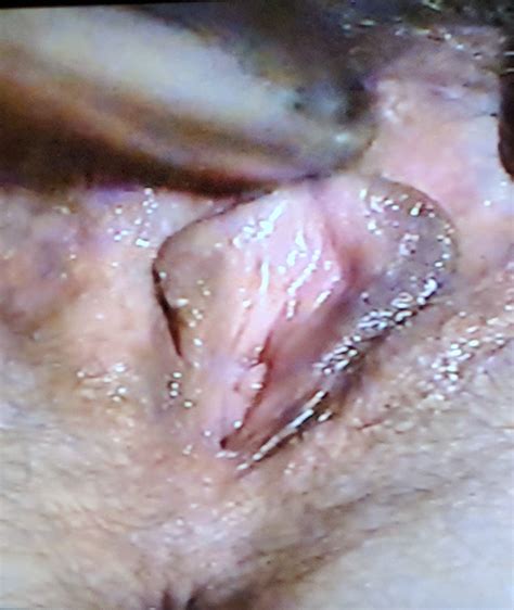 Show Your Pussy Page XNXX Adult Forum