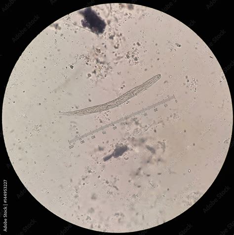 Parasite In Stool Under 40x Light Microscopy Strongyloides Stercoralis Is A Human Pathogenic