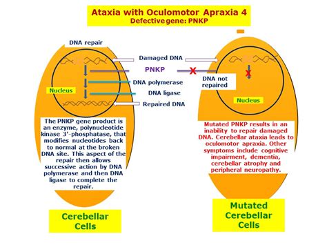 Ocular Motor Apraxia Therapy | Webmotor.org