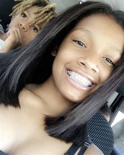 Pin By Shalux On Braceface Baddiess Braces Girls Brace Face