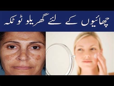 Chehre Ki Siya Chaiyan Khatam Karne Ka Ilaj Remedy Dark Spot And