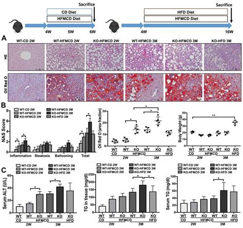 Lack Of Fgf21 Promotes Nash Hcc Transition Via Hepatocyte Tlr4 Il 17a