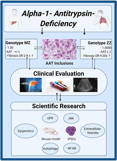 Clinical And Scientific Insights In Alpha1 Antitrypsin Deficiency