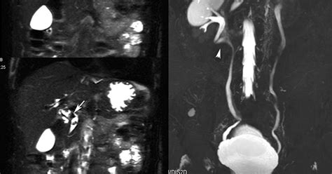 Radiodiagnosis Imaging Is Amazing Interesting Cases Oriental