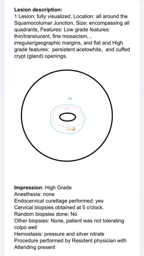 Help Decode Colposcopy Biopsy Results? : r/obgyn