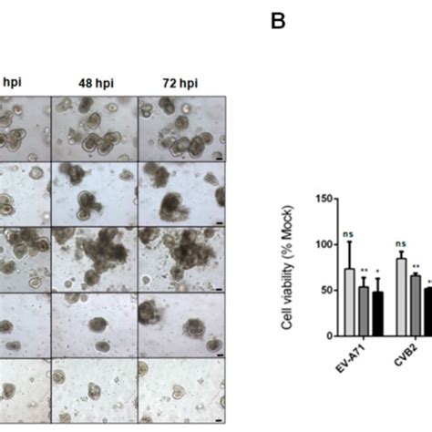 Cytopathic Effects And Cell Viability Reduction After Infections Of