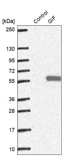 Anti-Intrinsic Factor antibody (ab262912) | Abcam