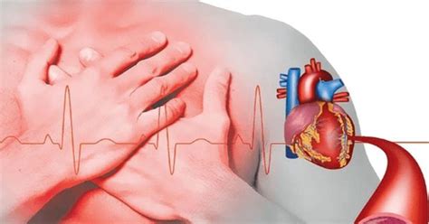 Importante Detecci N Oportuna De Cardiopat As Cong Nitas Imss Poniente