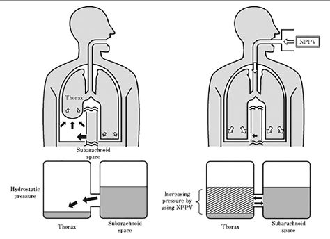 Figure From Positive Pressure Ventilation Attenuates Subarachnoid