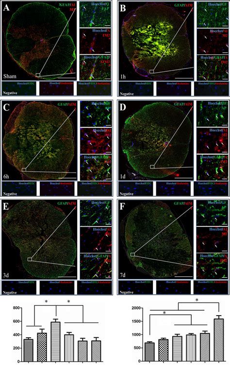 Co Localization Of Aim With Gfap In The Spinal Cords Of Sham Operated