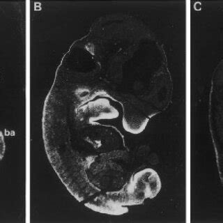 Expression Of M Twist In Mouse Embryos M Twist Transcripts Were