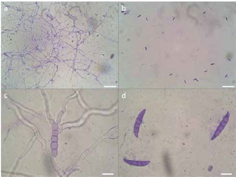 Light Microscopy Observations Of Fusarium Culmorum Strain Mzb47