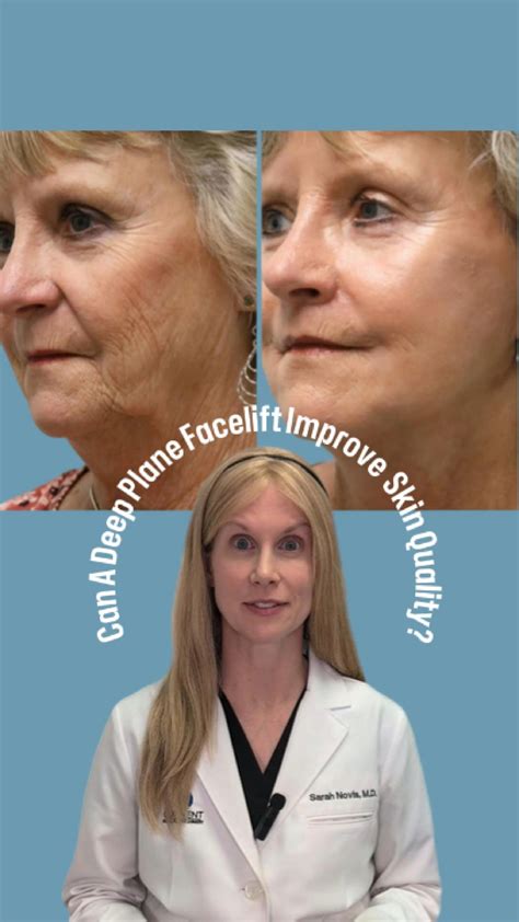 Dr. Sarah Novis (@dr.novis) • Instagram photos and videos