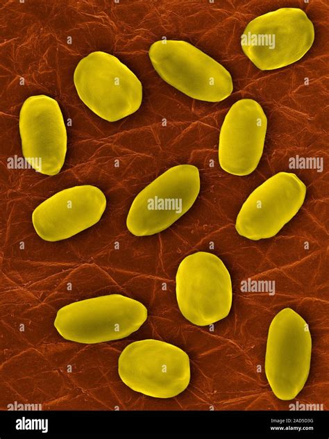 Coloured Scanning Electron Micrograph Sem Of Bacillus Anthracis