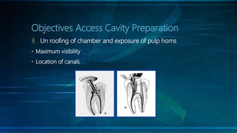 Endodontic Access Cavity Preparation PPT