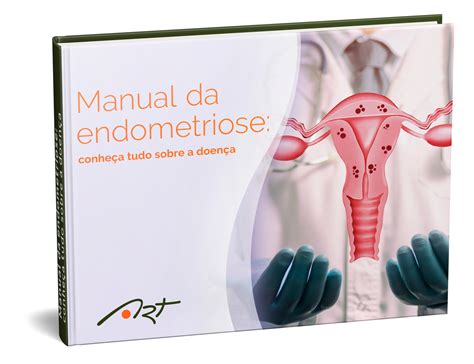 Manual da endometriose conheça tudo sobre a doença Art Medicina