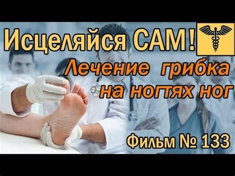 Грибок на ногах, грибок ногтей - откуда начинать лечение | Исцеляйся ...