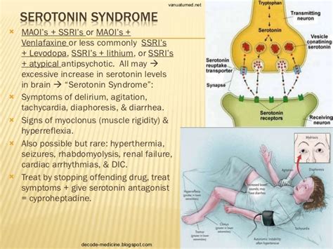 Serotonin Syndrome Brain