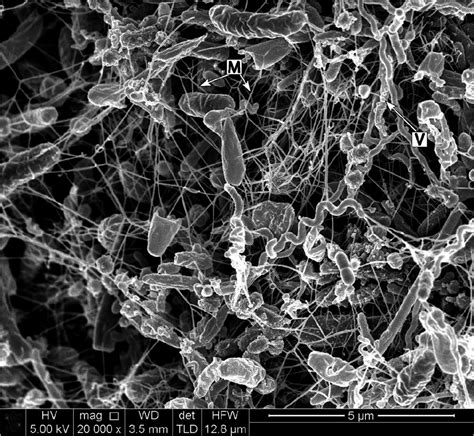 The Dental Plaque Biofilm Matrix Jakubovics Periodontology