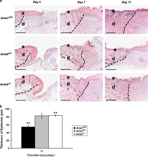 Histological Evaluation Of Wounded Skin A H E Staining Was Performed