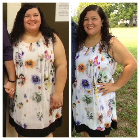 Before / After - BariatricPal