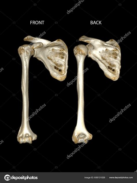 Computed Tomography Volume Rendering Examination Shoulder Joint Humerus