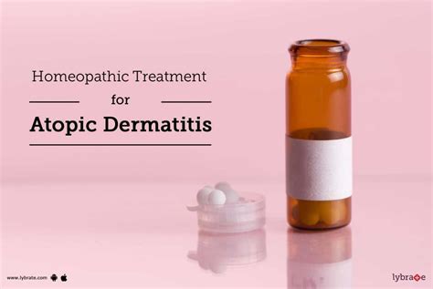 Homeopathic Treatment For Atopic Dermatitis By Dr Prashant Ruikar