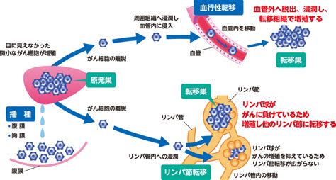 がんの基礎知識について ｜ Gtechジーテック株式会社