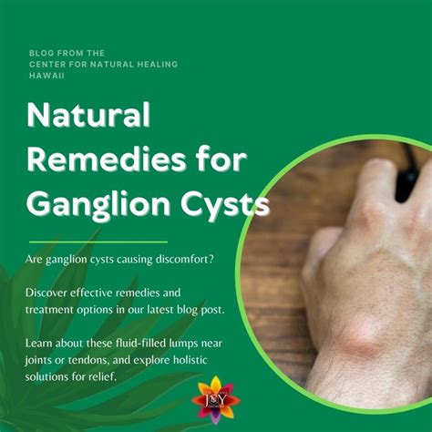 Homeopathic Remedies For Ganglion Cysts Dr Diana Joy Ostroff